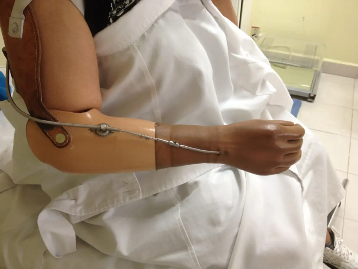 Fijación externa de brazo